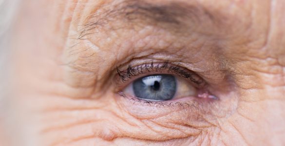 Diabetische Retinopathie