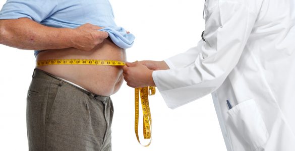 Viszerale Adipositas