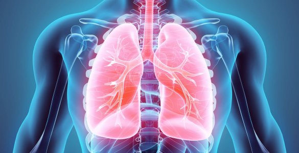 Pneumonie