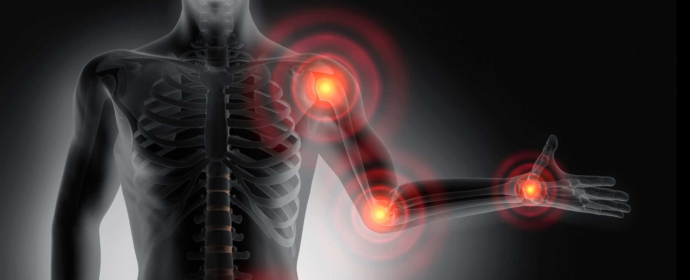 Rheuma Bekämpfen Ohne Medikamente Antientzündlicher Reflex Vagusnerv Stimulation Macht Es Möglich - fhpupkn