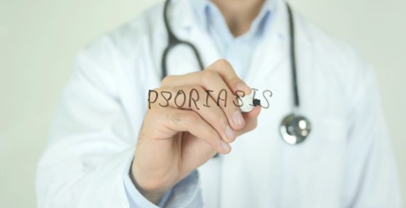 Psoriasis