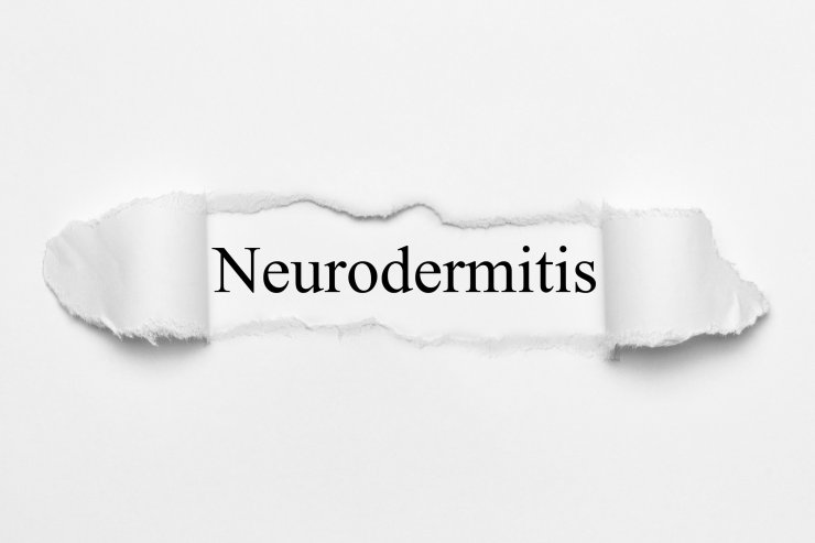 Neurodermitis