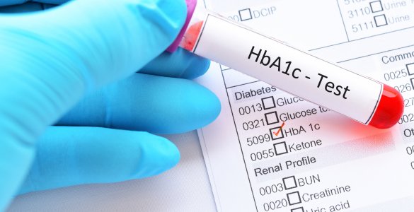 HbA1c-Test