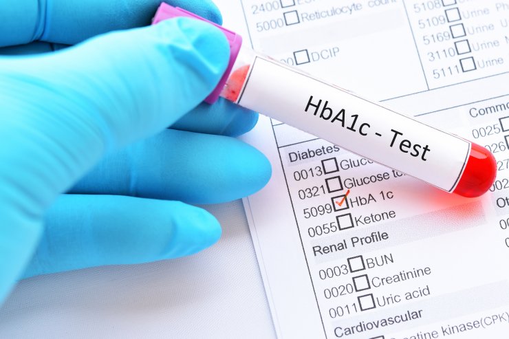 HbA1c-Test