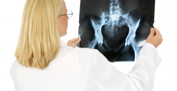 Ärztin betrachtet Röntgenbild